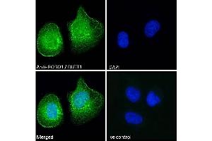 (ABIN185537) Immunofluorescence analysis of paraformaldehyde fixed U2OS cells, permeabilized with 0.
