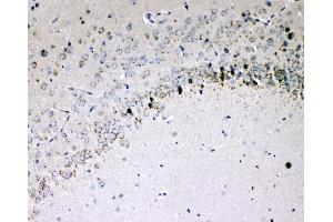 IHC analysis of IL-16 using anti-IL-16 antibody (ABIN5518927). (IL16 anticorps  (AA 1205-1322))