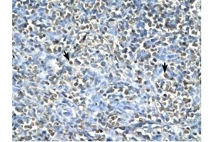 ASGR2 antibody was used for immunohistochemistry at a concentration of 4-8 ug/ml to stain Spleen cells (arrows) in Human Spleen.