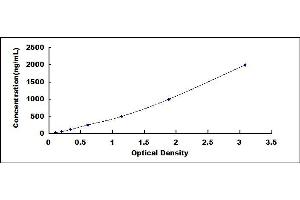 Typical standard curve (SERPINA1 Kit ELISA)