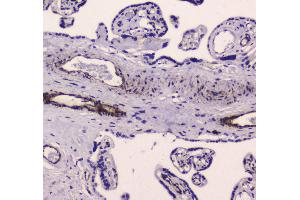 IHC analysis of MYLK using anti-MYLK antibody . (MYLK anticorps  (AA 1441-1709))