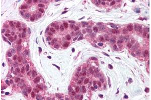 Human Breast (formalin-fixed, paraffin-embedded) stained with BCL10 antibody ABIN214584 at 5 ug/ml followed by biotinylated goat anti-rabbit IgG secondary antibody ABIN481713, alkaline phosphatase-streptavidin and chromogen. (BCL10 anticorps  (N-Term))