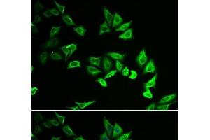Immunofluorescence analysis of U2OS cells using MYOZ2 Polyclonal Antibody (MYOZ2 anticorps)