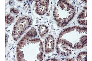Immunohistochemical staining of paraffin-embedded Human breast tissue using anti-PDLIM2 mouse monoclonal antibody. (PDLIM2 anticorps)