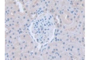 IHC-P analysis of Rat Kidney Tissue, with DAB staining. (ITSN1 anticorps  (AA 1-227))