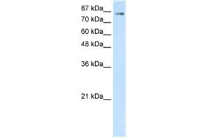 WB Suggested Anti-SMARCA3 Antibody Titration:  5. (HLTF anticorps  (C-Term))