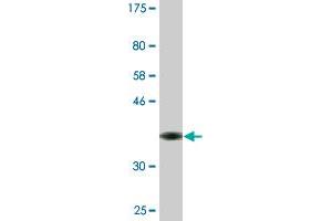 Western Blot detection against Immunogen (36.