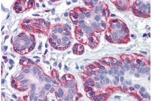 anti-Zyxin (ZYX) (AA 1-573) antibody