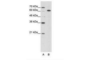 Image no. 2 for anti-Small Nuclear Ribonucleoprotein 70kDa (U1) (SNRNP70) (AA 21-70) antibody (ABIN203140) (SNRNP70 anticorps  (AA 21-70))
