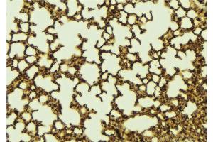 ABIN6267185 at 1/100 staining Mouse lung tissue by IHC-P. (NCOA3 anticorps  (pThr24))