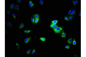 Immunofluorescence staining of HepG2 cells with ABIN7146784 at 1:333, counter-stained with DAPI.