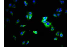 Immunofluorescence staining of HepG2 cells with ABIN7146784 at 1:333, counter-stained with DAPI. (CEACAM1 anticorps  (AA 35-428))