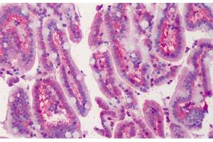 Human Small Intestine: Formalin-Fixed, Paraffin-Embedded (FFPE) (LASP1 anticorps  (AA 141-153))