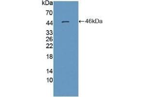 Detection of Recombinant MSE, Human using Polyclonal Antibody to Enolase 3 (ENO3) (ENO3 anticorps  (AA 1-391))