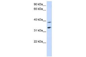 SLC25A34 antibody used at 1 ug/ml to detect target protein. (SLC25A34 anticorps  (Middle Region))