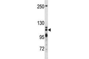 XRN2 antibody western blot analysis in T47D lysate