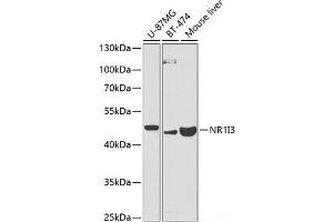 Western blot analysis of extracts of various cell lines using NR1I3 Polyclonal Antibody at dilution of 1:1000. (NR1I3 anticorps)