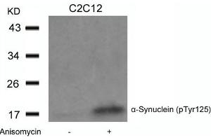 Western blot analysis of extracts from C2C12 cells untreated or treated with Anisomycin using a-Synuclein(Phospho-Tyr125) Antibody. (SNCA anticorps  (pTyr125))