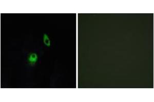 Immunofluorescence analysis of HeLa cells, using GPR124 Antibody. (GPR124 anticorps  (AA 1151-1200))