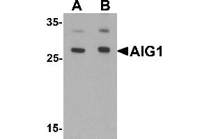 Western blot analysis of AIG1 in human brain tissue lysate with AIG1 antibody at (A) 1 and (B) 2 µg/mL. (AIG1 anticorps  (N-Term))