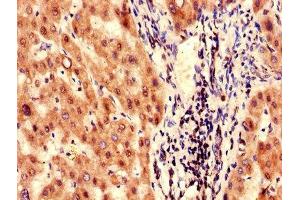 Immunohistochemistry of paraffin-embedded human liver tissue using ABIN7153235 at dilution of 1:100