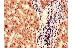 Immunohistochemistry of paraffin-embedded human liver tissue using ABIN7153235 at dilution of 1:100 (FAH anticorps  (AA 2-250))