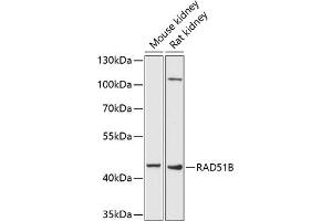 Western blot analysis of extracts of various cell lines, using RB antibody (ABIN6132613, ABIN6146640, ABIN6146643 and ABIN6222714) at 1:1000 dilution. (RAD51 Homolog B anticorps  (AA 1-384))