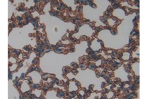 DAB staining on IHC-P; Samples: Mouse Lung Tissue