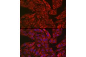 Immunofluorescence analysis of U2OS cells using GSDME antibody (ABIN6127757, ABIN6139554, ABIN6139555 and ABIN6223304) at dilution of 1:50. (Non-Syndromic Hearing Impairment Protein 5 (GSDME) (AA 1-260) anticorps)