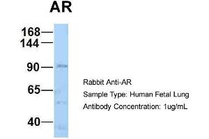 Host: Rabbit Target Name: AR Sample Type: Human Fetal Lung Antibody Dilution: 1. (Androgen Receptor anticorps  (N-Term))