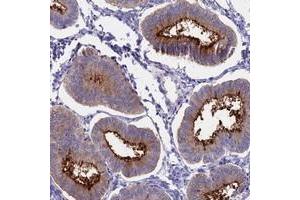 Immunohistochemical staining of human uterus, pre-menopause with OR2AE1 polyclonal antibody  shows distinct membranous positivity in glandular cells at 1:50-1:200 dilution. (Olfactory Receptor, Family 2, Subfamily AE, Member 1 (OR2AE1) anticorps)