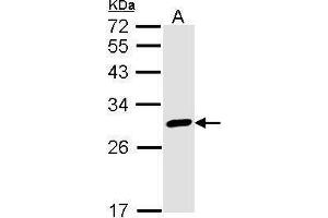 Western Blotting (WB) image for anti-Calbindin 2 (CALB2) antibody (ABIN2855596)