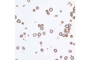 Immunocytochemistry (ICC) image for anti-Poliovirus Receptor (PVR) (AA 28-329) antibody (ABIN7449549) (Recombinant Poliovirus Receptor anticorps  (AA 28-329))