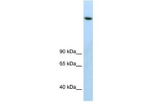 WB Suggested Anti-JMJD1B Antibody Titration:  2. (KDM3B anticorps  (C-Term))