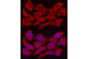Immunofluorescence analysis of HeLa cells using /GSNOR Rabbit pAb (ABIN6131172, ABIN6136579, ABIN6136580 and ABIN6217464) at dilution of 1:50 (40x lens).