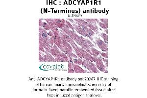Image no. 2 for anti-Adenylate Cyclase Activating Polypeptide 1 (Pituitary) Receptor Type I (ADCYAP1R1) (Extracellular Domain), (N-Term) antibody (ABIN1731541) (ADCYAP1R1 anticorps  (Extracellular Domain, N-Term))