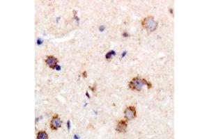 Immunohistochemical analysis of MYPT1 staining in human brain formalin fixed paraffin embedded tissue section. (PPP1R12A anticorps)