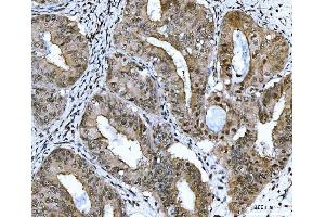 IHC analysis of CSNK2K2 using anti-CSNK2K2 antibody (ABIN7602871).