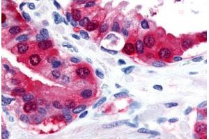 Anti-TRPM8 antibody  ABIN1049435 IHC staining of human prostate. (TRPM8 anticorps  (Internal Region))