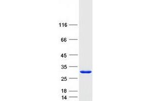 Validation with Western Blot