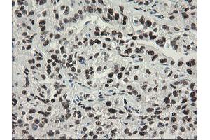 Image no. 20 for anti-Transducin-Like Enhancer of Split 1 (E(sp1) Homolog, Drosophila) (TLE1) (AA 180-460) antibody (ABIN1491049)