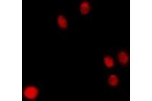 Immunofluorescent analysis of p47 staining in Hela cells. (CLEC11A anticorps)