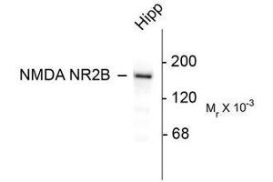 Image no. 1 for anti-Glutamate Receptor, Ionotropic, N-Methyl D-Aspartate 2B (GRIN2B) (C-Term) antibody (ABIN372682) (GRIN2B anticorps  (C-Term))