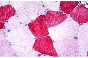 Human Skeletal Muscle: Formalin-Fixed, Paraffin-Embedded (FFPE) (UBE2O anticorps  (AA 1279-1292))