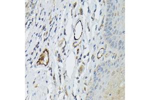 Immunohistochemistry of paraffin-embedded human esophagus using von Willebrand factor (VWF) Rabbit pAb (ABIN3015449, ABIN3015450, ABIN5663874 and ABIN6217310) at dilution of 1:50 (40x lens).