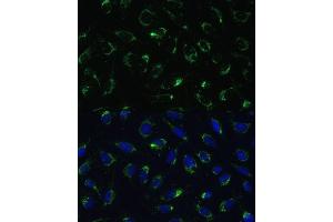 Immunofluorescence analysis of U-2 OS cells using COX5B antibody (ABIN3016355, ABIN3016356, ABIN3016357 and ABIN6219733) at dilution of 1:100.