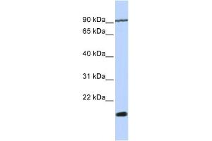 WB Suggested Anti-TM4SF4 Antibody Titration:  0. (TM4SF4 anticorps  (N-Term))
