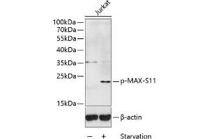 Western blot analysis of extracts of Jurkat cells, using Phospho-MAX-S11 antibody (ABIN3019514, ABIN3019515, ABIN3019516 and ABIN6225442) at 1:1000 dilution. (MAX anticorps  (pSer11))