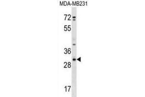 Western Blotting (WB) image for anti-Cysteine-Rich Secretory Protein 1 (CRISP1) antibody (ABIN2999601) (CRISP1 anticorps)