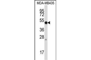 P28 Antibody (Center) (ABIN657656 and ABIN2846650) western blot analysis in MDA-M cell line lysates (35 μg/lane). (MMP28 anticorps  (AA 195-223))